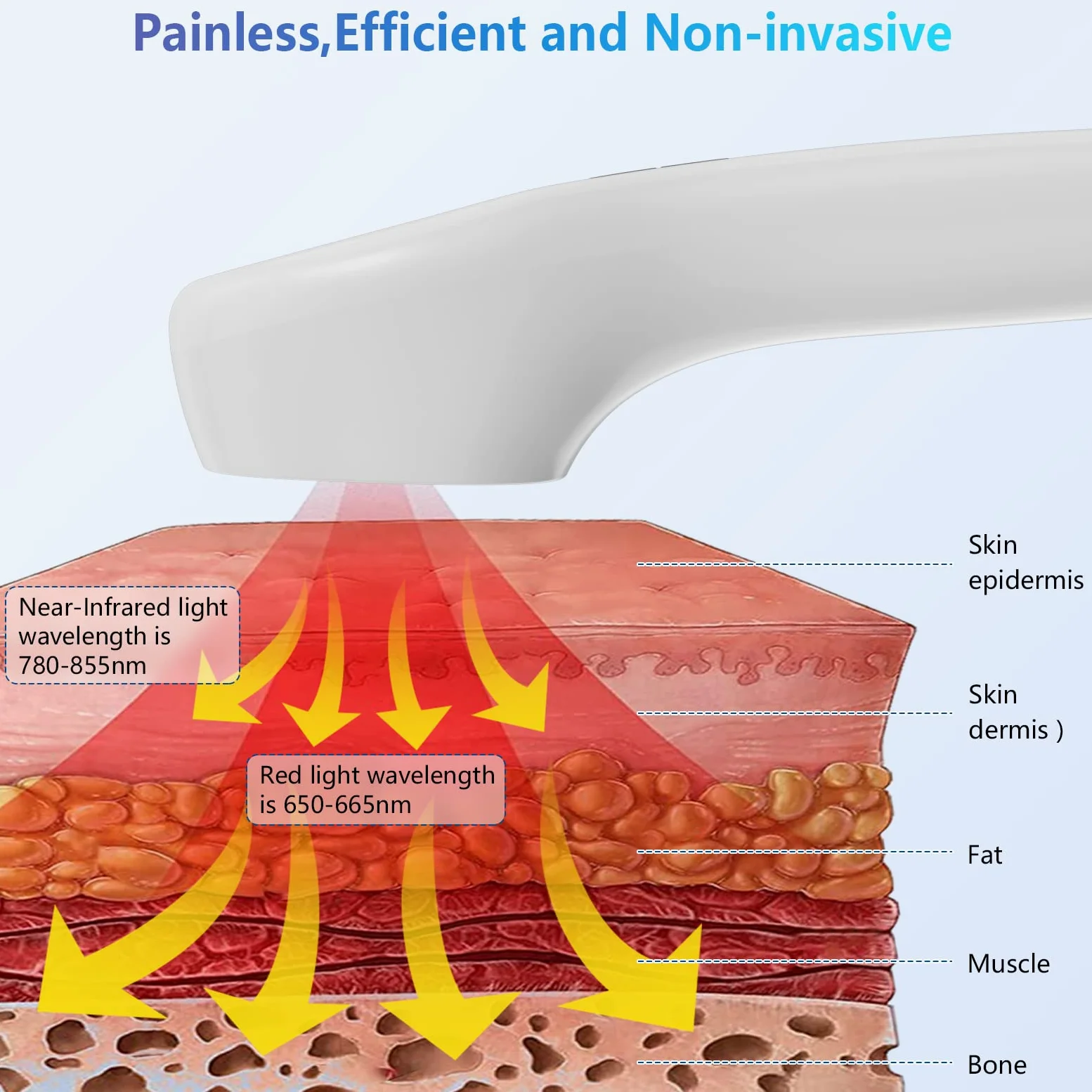 iKeener Terapia Luce Rossa Dispositivo,FDA Approvata Attrezzatura Alleviare Portatile Dolore,Terapia Laser Freddo Apparecchio per Schiena,Viso,Corpo,Muscoli,Ginocchio,Spalla,con Occhiali(4x808nm)